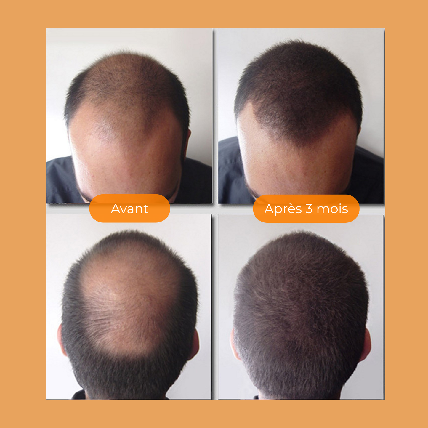 Shampoing Solide Gingembre Bio – Densifiant & Stimulant – Volume & Anti-Casse